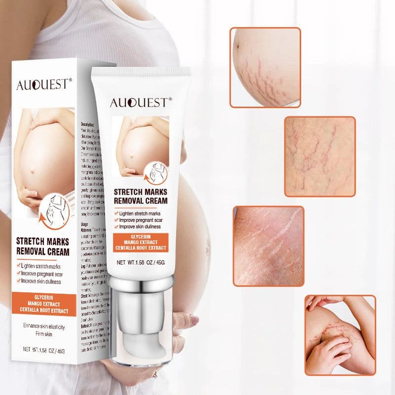 image-Remove Pregnancy Scars Acne Cream Stretch Mark Treatment Maternity Repair Anti-Aging Anti-Winkle Firming Body Cream