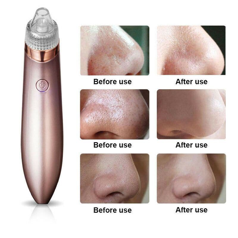 image-Electric Blackhead Vacuum Pore Cleaner Acne Pimple Remover Strong Suction Tool Electric Blackhead Remover Pore Vacuum Suction Diamond Dermabrasion Face Cleaner