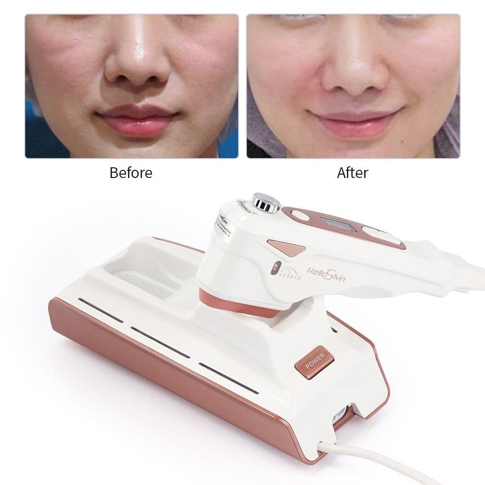 image-Home V Face Lifting Ultrasonic Knife Lifting Anti-aging Beauty Instrument