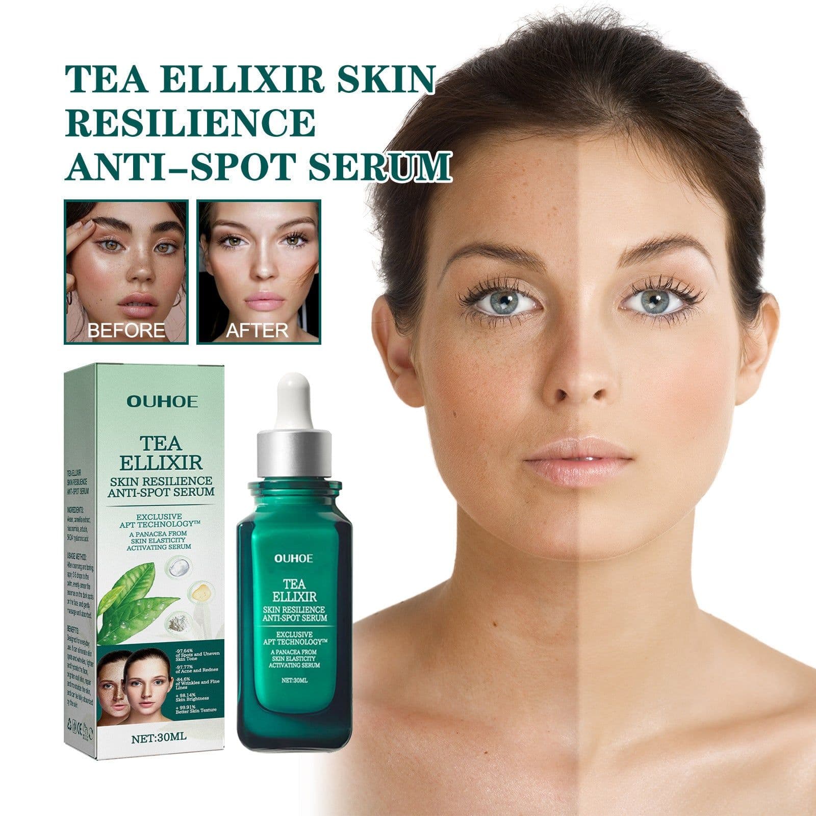 image-Brightening And Lightening Melasma Blemish Moisturizing And Brightening Skin
