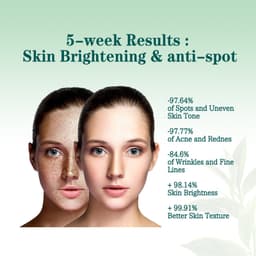 image-Brightening And Lightening Melasma Blemish Moisturizing And Brightening Skin