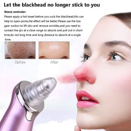 image-Electric Blackhead Remover Pore Vacuum Suction Diamond Dermabrasion Face Cleaner