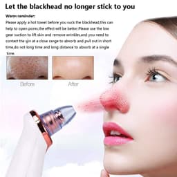 image-Electric Blackhead Remover Pore Vacuum Suction Diamond Dermabrasion Face Cleaner