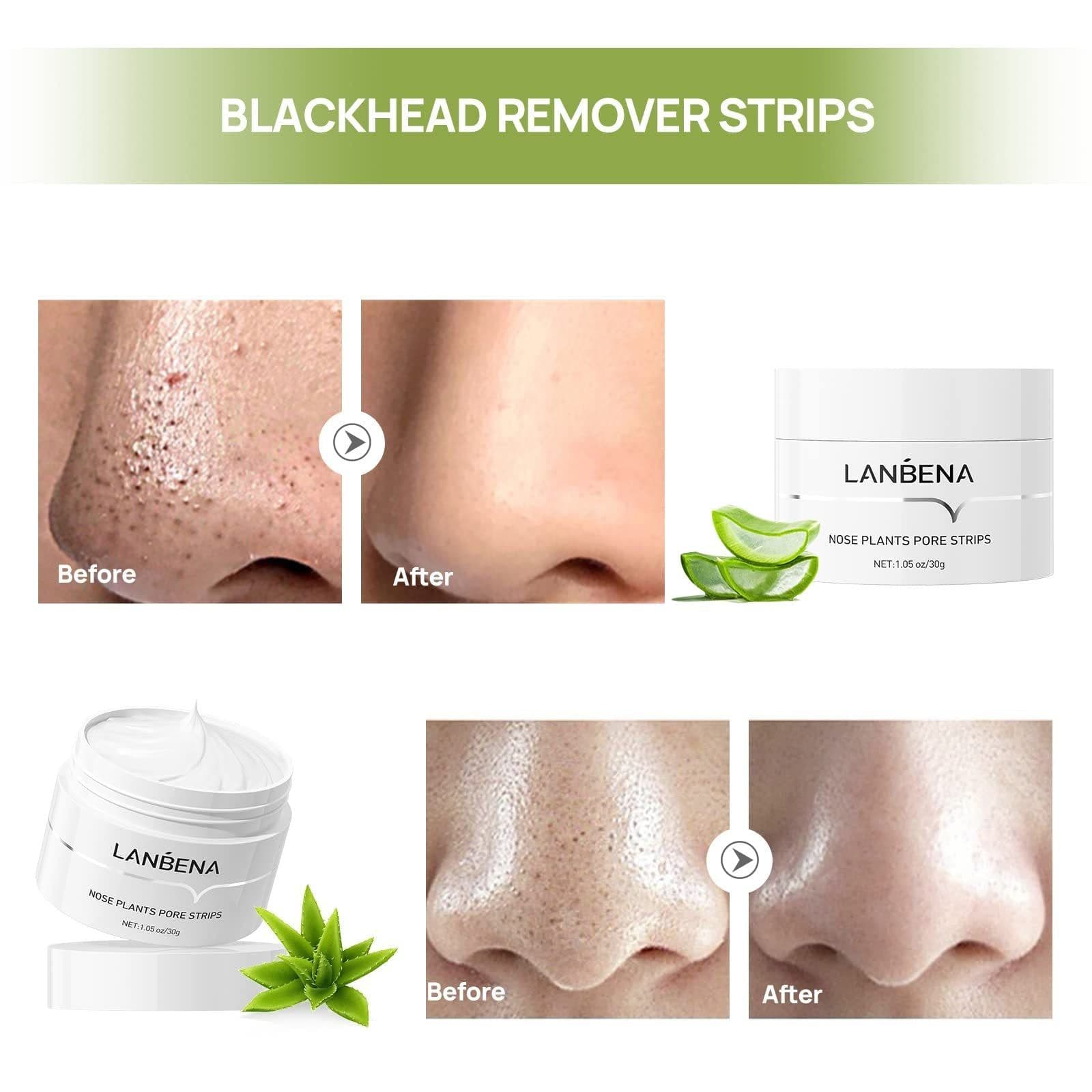 image-LANBENA Puntos Negros, Blackhead Mask Pore Strips, Deep Cleansing For All Skin Types, Unisex