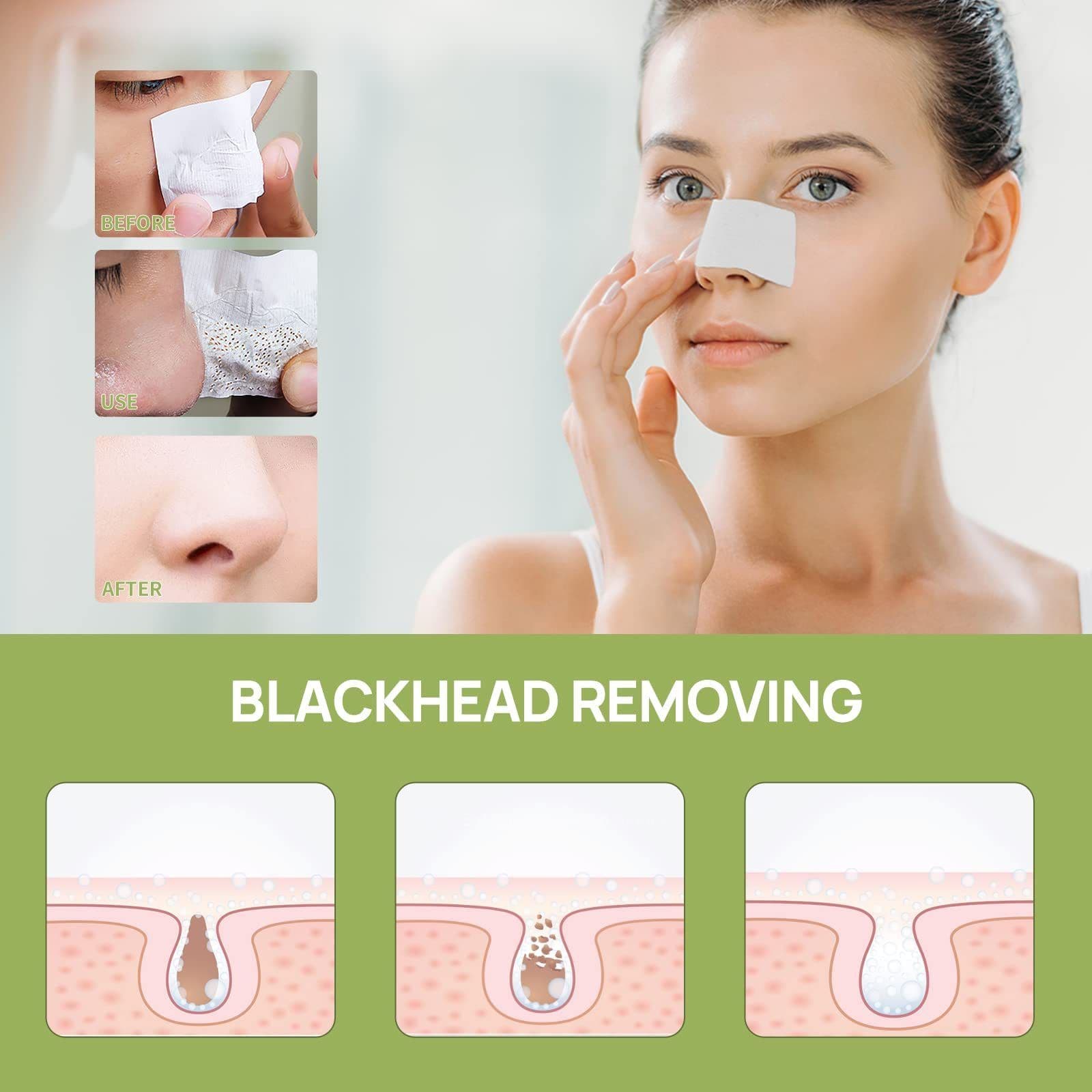 image-LANBENA Puntos Negros, Blackhead Mask Pore Strips, Deep Cleansing For All Skin Types, Unisex