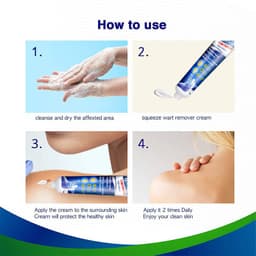 image-Warts Remover Antibacterial Ointment Wart Treatment Cream Skin Tag Remover Herbal Extract Corn Plaster Warts Ointment