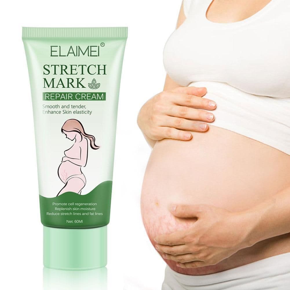 image-Stretch Mark Repair Cream Smooth Tender Enhance Skin Elastictiy Acne Repair 60ml Anti-Aging Cream Pregnancy Scars