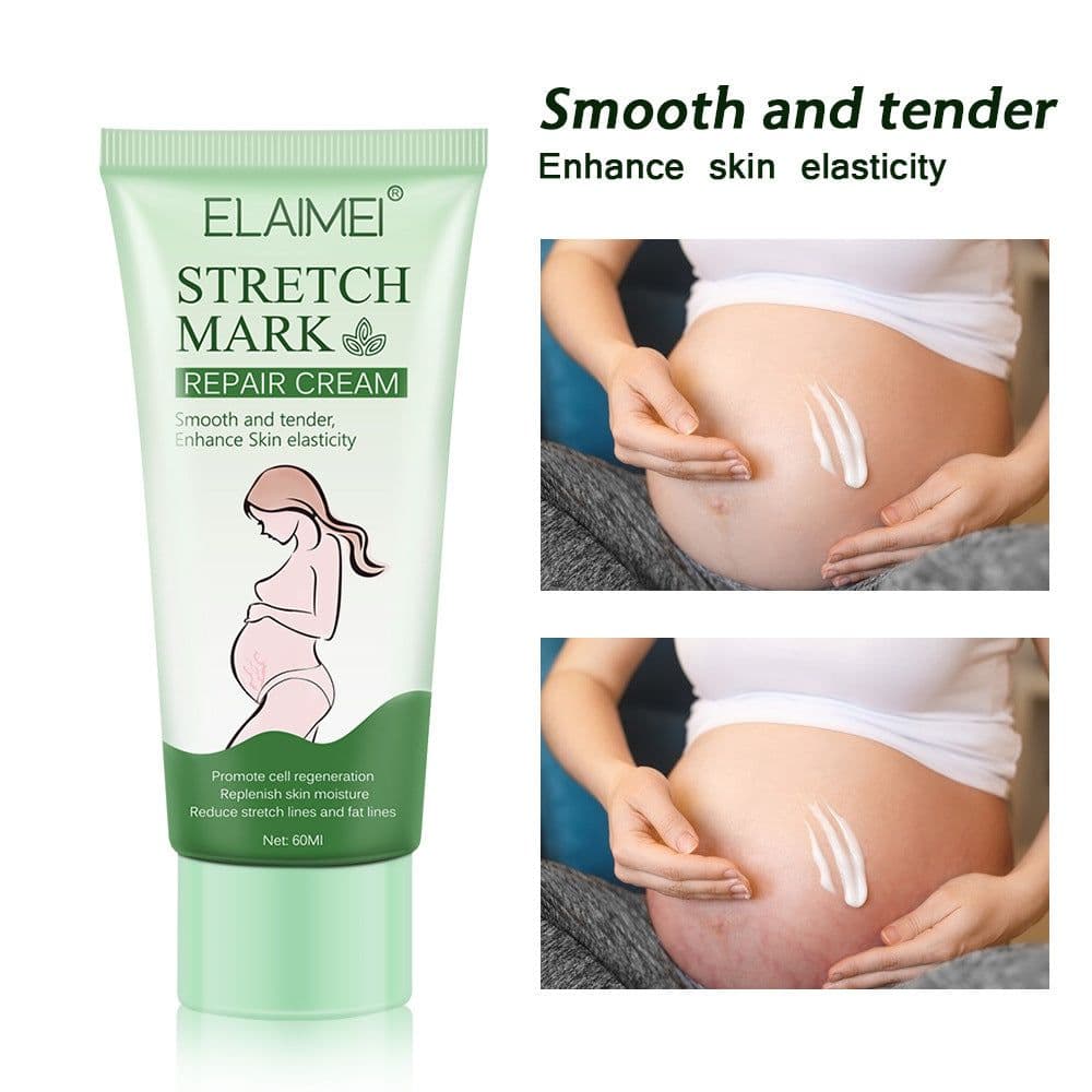 image-Stretch Mark Repair Cream Smooth Tender Enhance Skin Elastictiy Acne Repair 60ml Anti-Aging Cream Pregnancy Scars