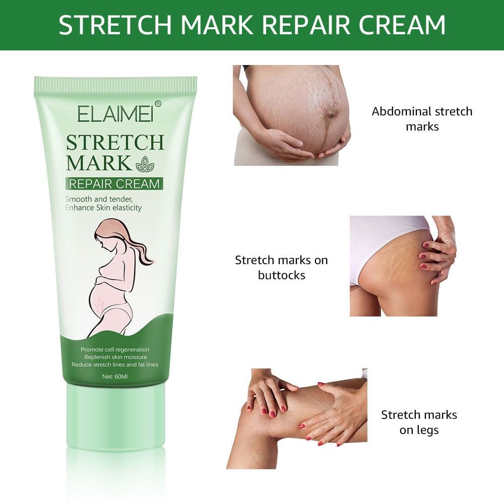 image-Stretch Mark Repair Cream Smooth Tender Enhance Skin Elastictiy Acne Repair 60ml Anti-Aging Cream Pregnancy Scars