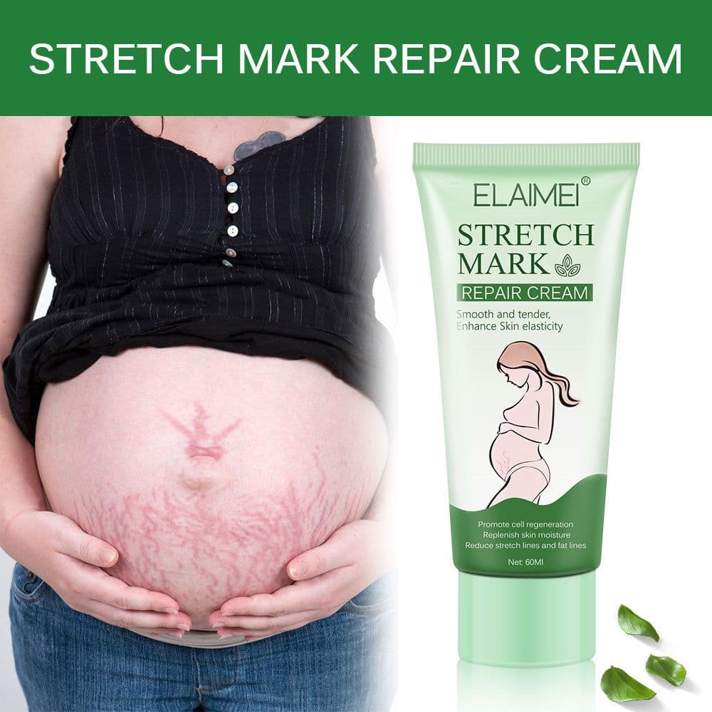 image-Stretch Mark Repair Cream Smooth Tender Enhance Skin Elastictiy Acne Repair 60ml Anti-Aging Cream Pregnancy Scars