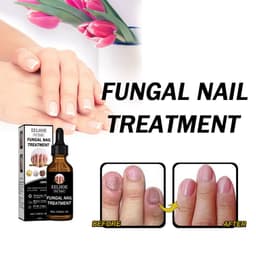 image-Onychomycosis Dead Skin And Repairing Lotion