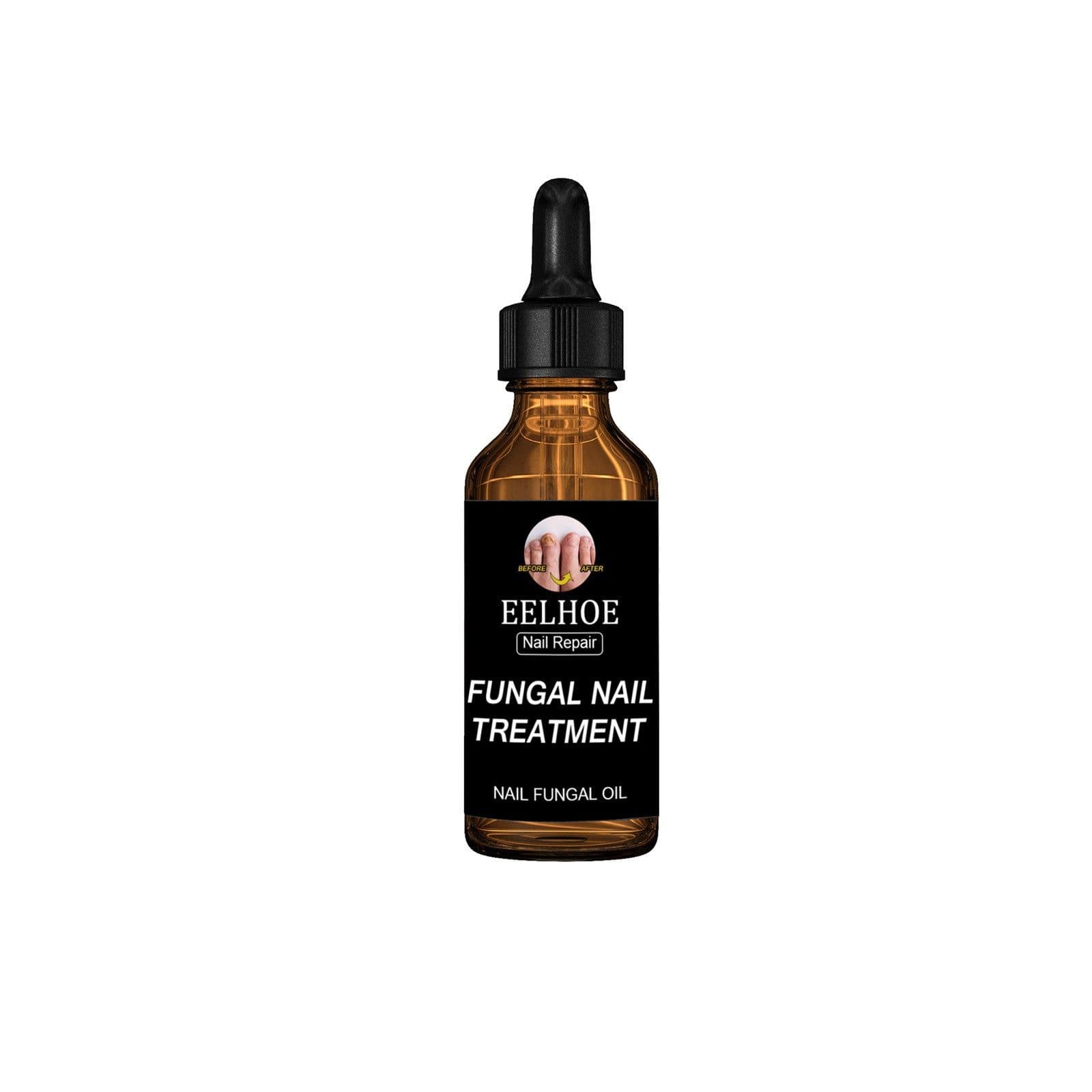 image-Onychomycosis Dead Skin And Repairing Lotion