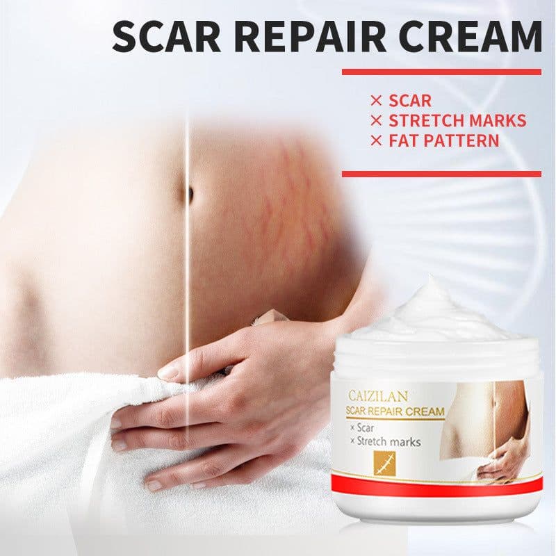 image-Pregnant Women Acne Scar Repair Cream Skin Care 30g