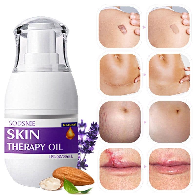 image-Skin Treatment Oil Remove Puncture Cellulite Stretch Mark Repair Body Care 30ml