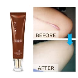 image-Moisturizing And Repairing Scar Skin Care Cream