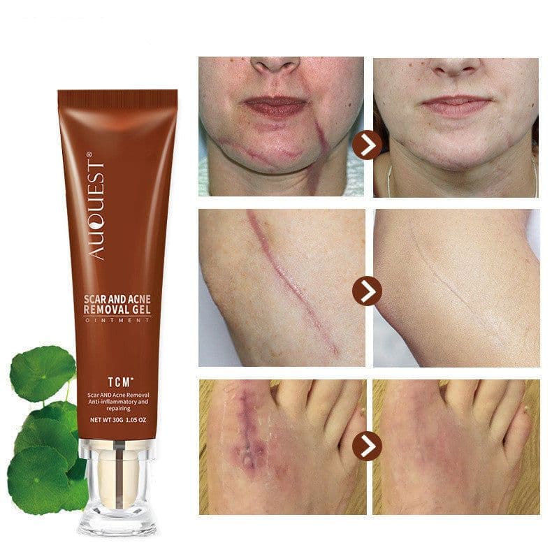 image-Moisturizing And Repairing Scar Skin Care Cream