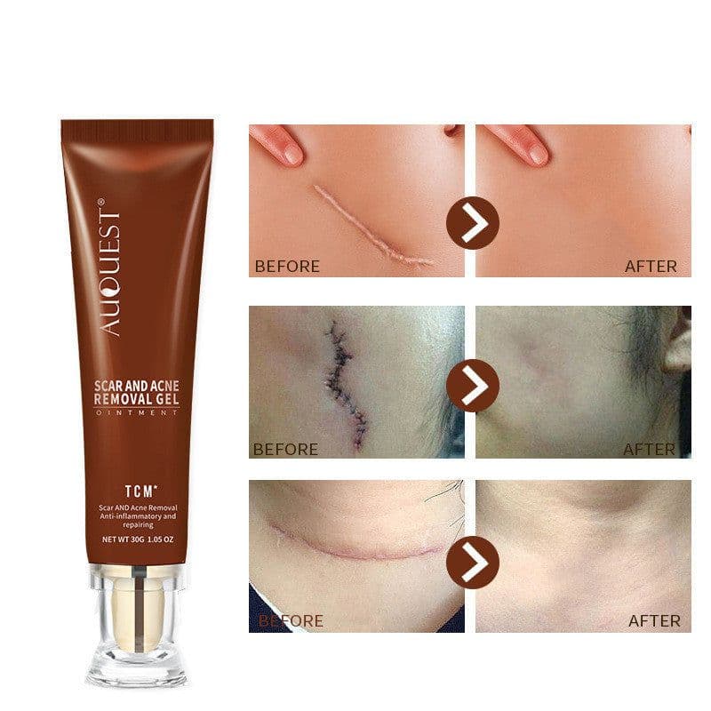 image-Moisturizing And Repairing Scar Skin Care Cream