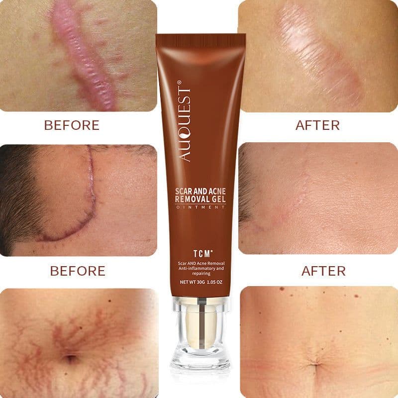 image-Moisturizing And Repairing Scar Skin Care Cream