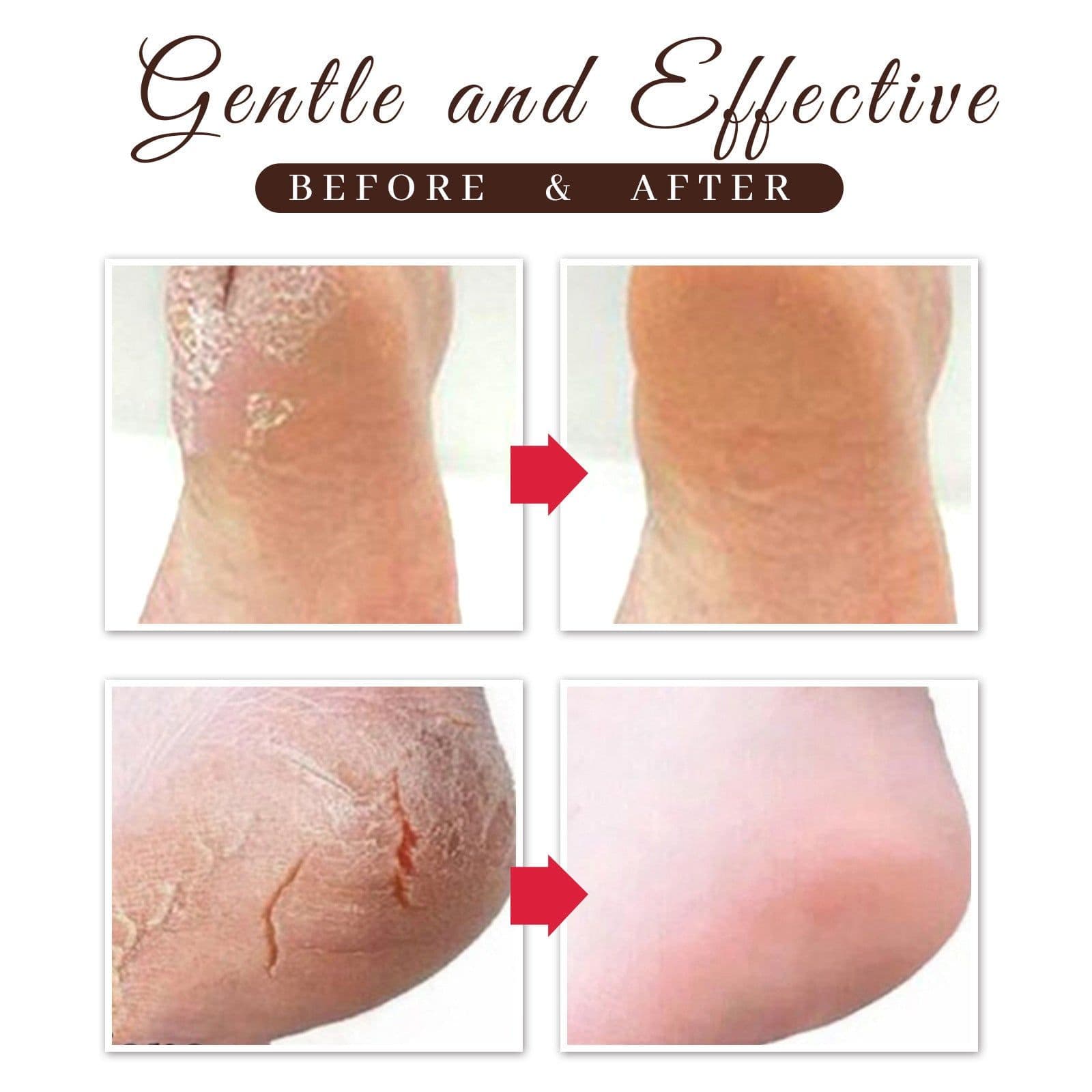 image-Horse Oil Foot Repair Cream For Dry And Peeling Feet