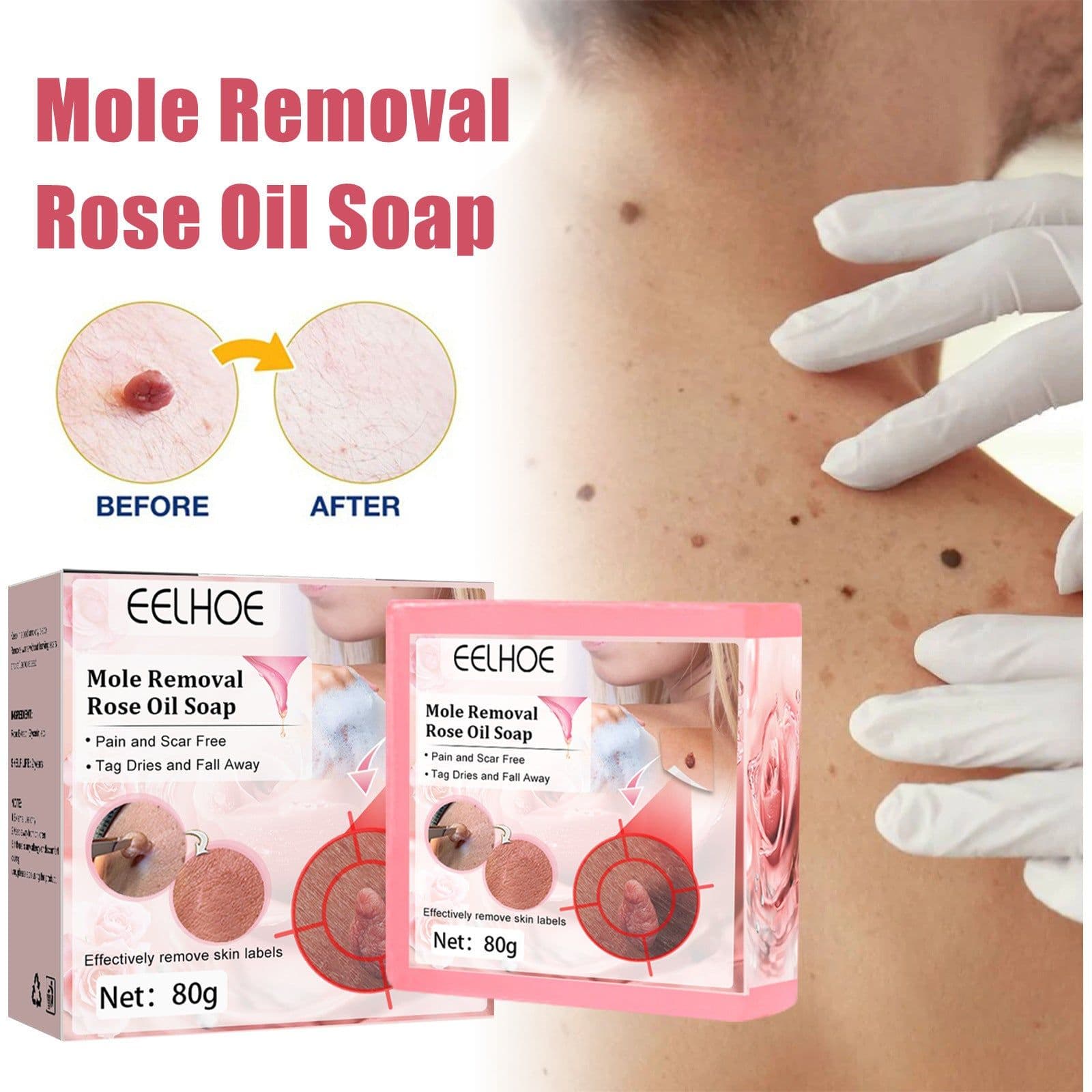 image-Cure Warts Remove Moles Face And Neck Filamentous Warts Body Cleaning Soap