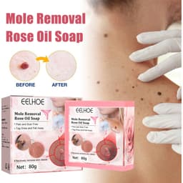 image-Cure Warts Remove Moles Face And Neck Filamentous Warts Body Cleaning Soap