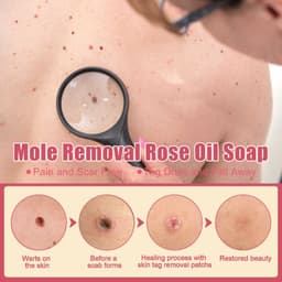 image-Cure Warts Remove Moles Face And Neck Filamentous Warts Body Cleaning Soap