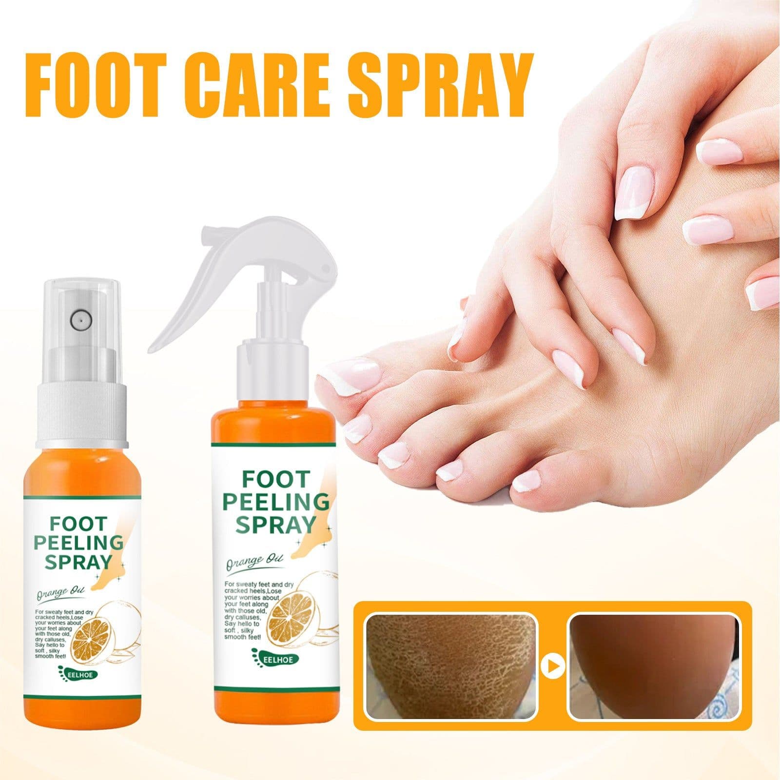 image-Exfoliate Feet Remove Dead Skin And Calluses Heel Elbow And Knee Care Spray