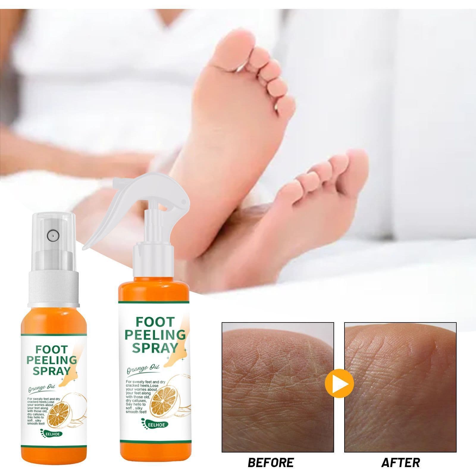image-Exfoliate Feet Remove Dead Skin And Calluses Heel Elbow And Knee Care Spray
