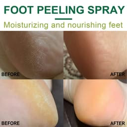 image-Exfoliate Feet Remove Dead Skin And Calluses Heel Elbow And Knee Care Spray