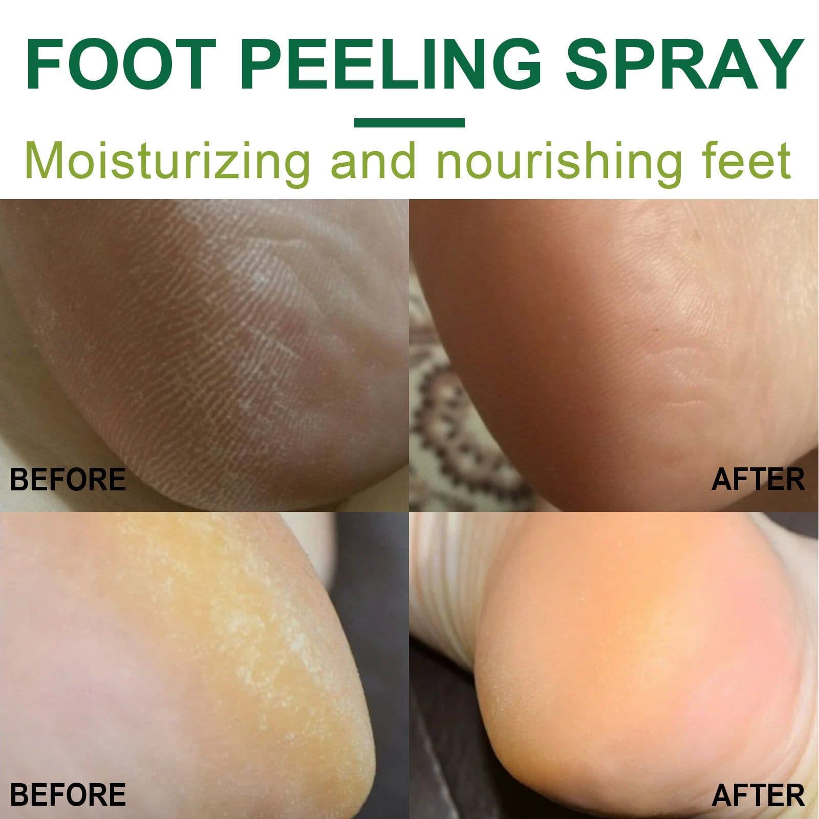 image-Exfoliate Feet Remove Dead Skin And Calluses Heel Elbow And Knee Care Spray