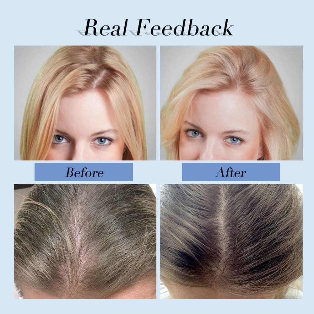 image-Anti-dandruff Nourishing Shouaconite Shampoo Dew For Men And Women