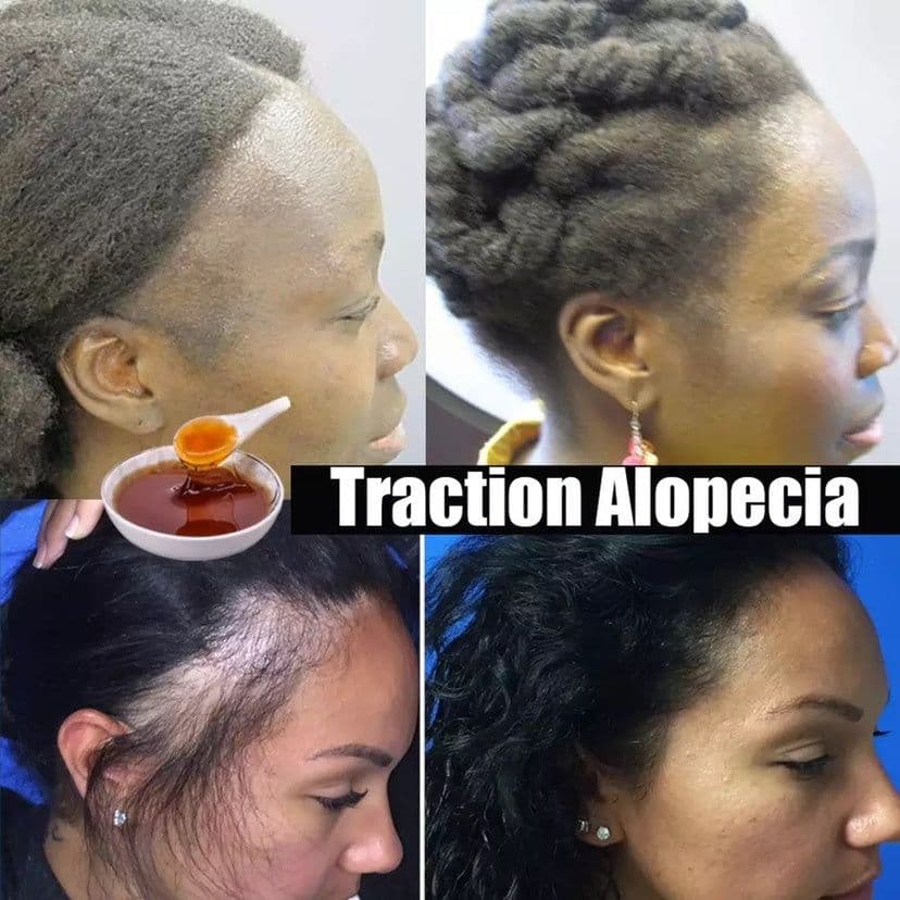 image-Africa Naturl Herbal Shampoo Crazy Hair Growth Chebe Powder