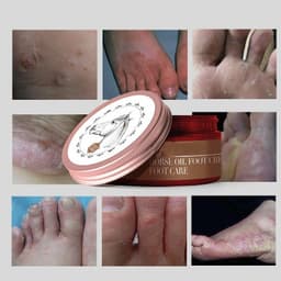 image-Moisturizing Horse Oil Foot Care Cream