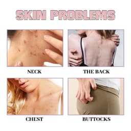 image-Chest Back Cleansing Fade Acne Print Skin Care Ball