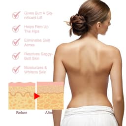 image-Chest Back Cleansing Fade Acne Print Skin Care Ball