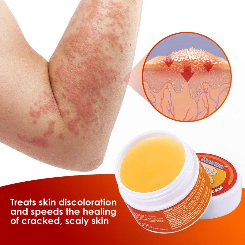 image-Dermatitis Eczemn Tinea Itching Silver Shavings And Antipruritic Skin care lotion