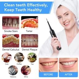 image-Electric Dental Appliance High Frequency Vibration Dental Instrument Set