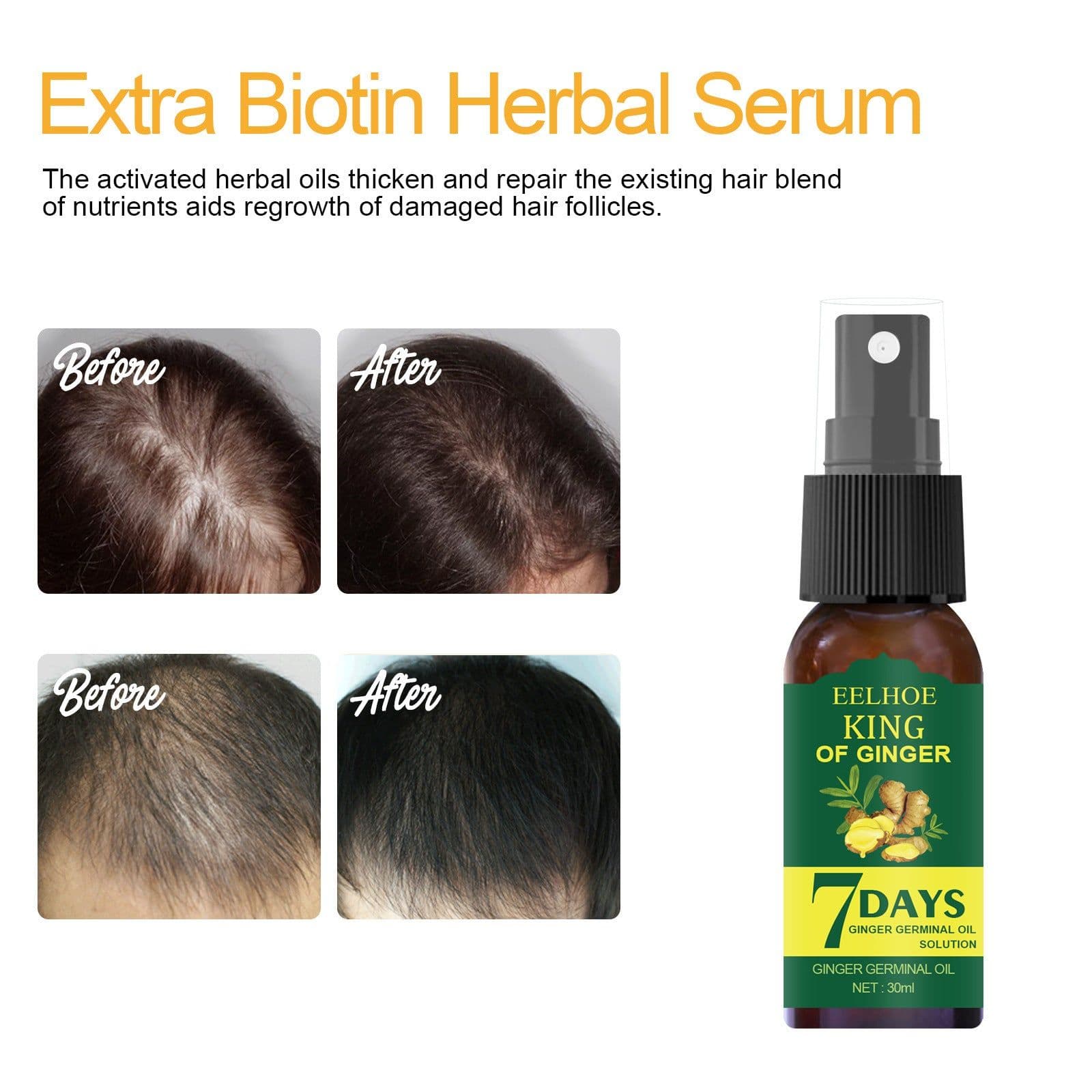 image-EELHOE Foreign Trade Cross-border Ginger Nutrition Spray Ginger Hair Root Spray Moisturizing Hair Hair Care Spray Spray