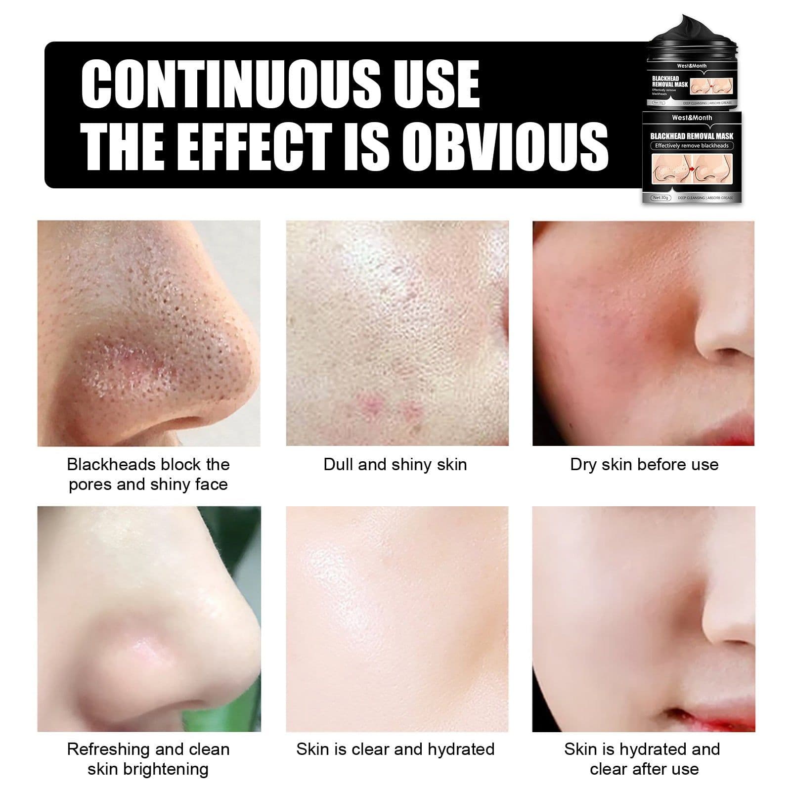 image-Bamboo Charcoal Blackhead Suction Mask Cleaning Tear And Pull Nose Mask Blackhead Suction Acne