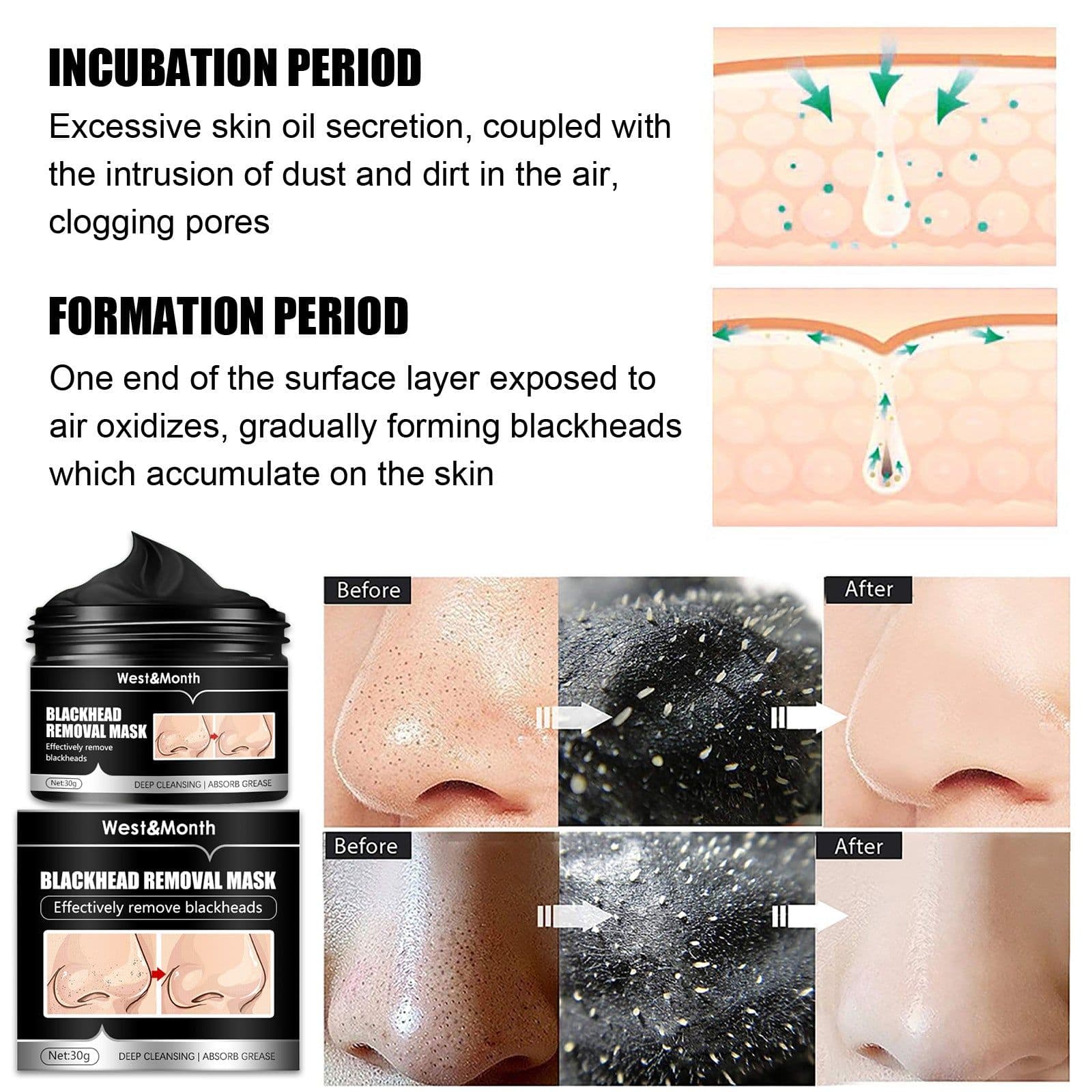 image-Bamboo Charcoal Blackhead Suction Mask Cleaning Tear And Pull Nose Mask Blackhead Suction Acne