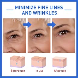 image-Anti-Wrinkle Firming Head Lifting Pattern French Pattern Fading Wrinkle Botox