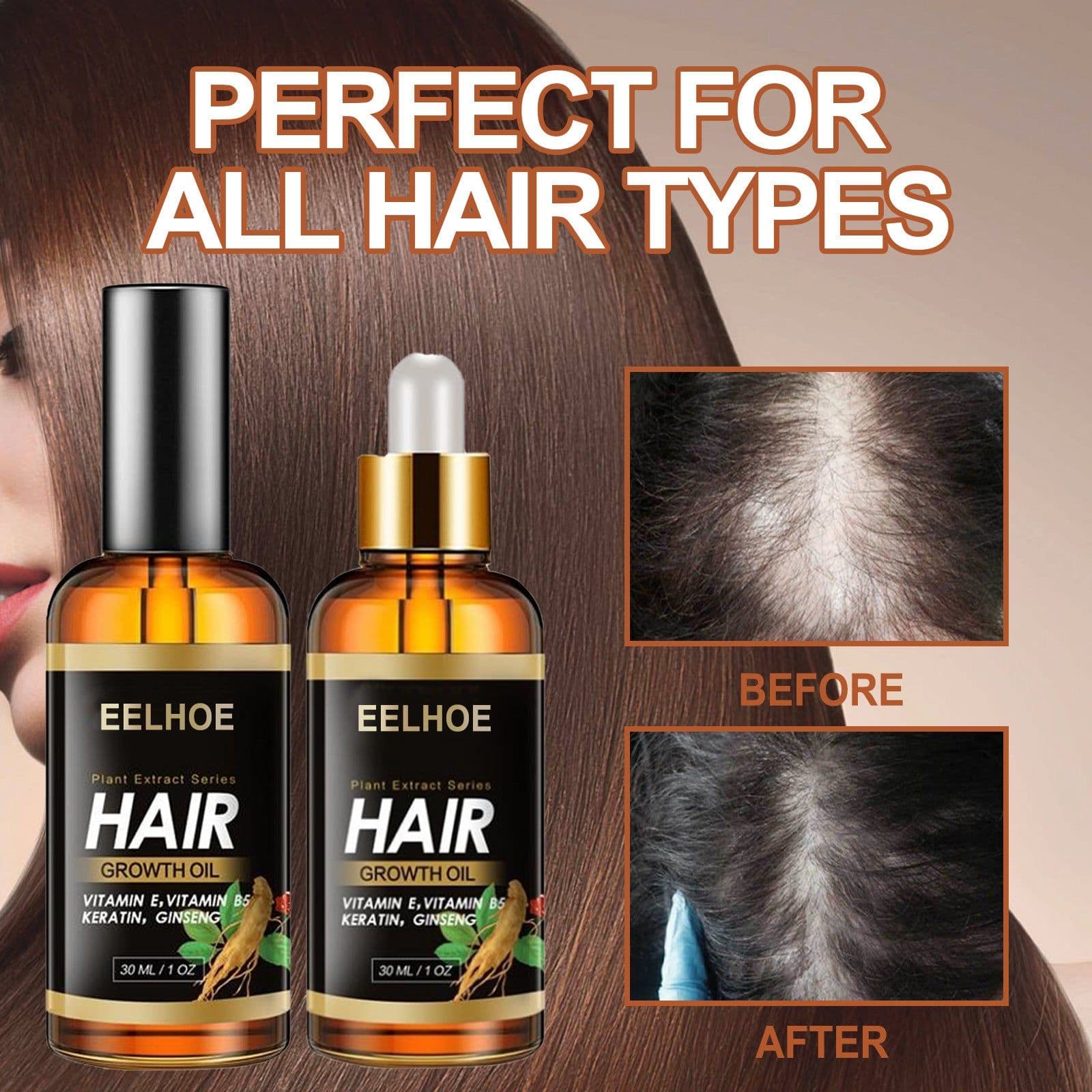 image-EELHOE Herb Hair Hairdressing Hair Care Essential Oil Hair Strong Hair Reduce Hair Loss Broken Hair Hair Care Essential Oil