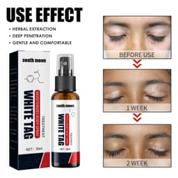 image-White Net Spray Repair Flower Spot Liquid For External Skin Care