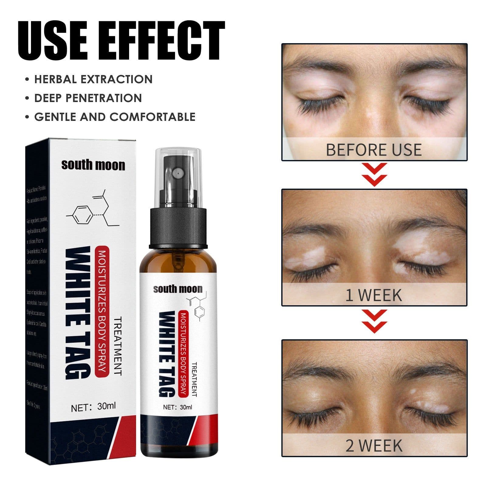 image-White Net Spray Repair Flower Spot Liquid For External Skin Care