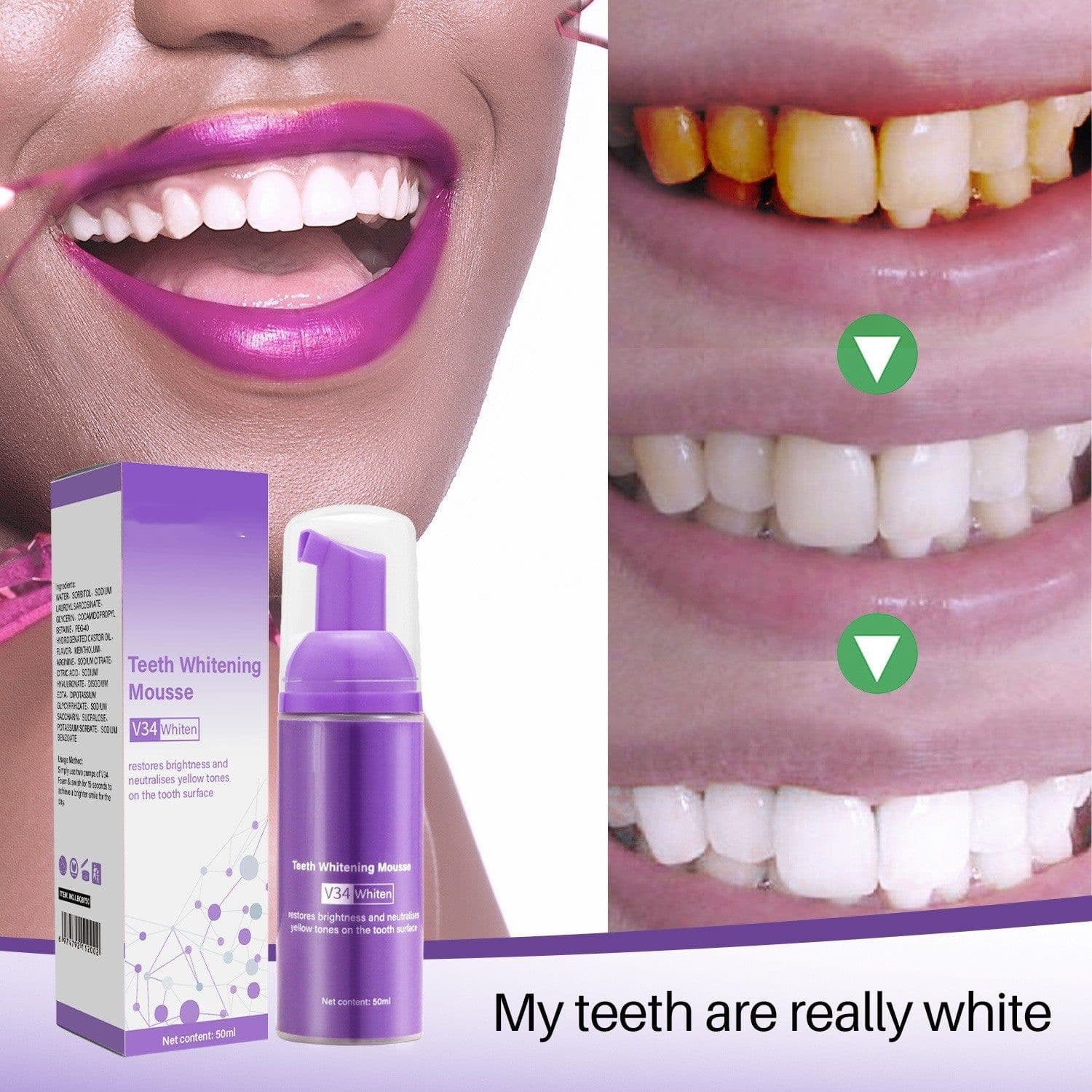 image-Remove Smoke Stains From Teeth Oral Care Teeth Mousse