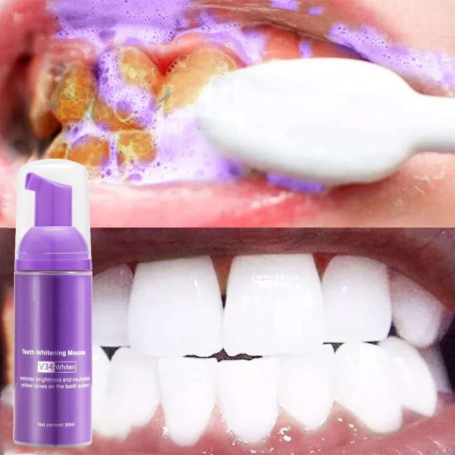 image-Remove Smoke Stains From Teeth Oral Care Teeth Mousse