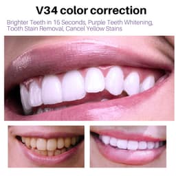 image-Remove Smoke Stains From Teeth Oral Care Teeth Mousse