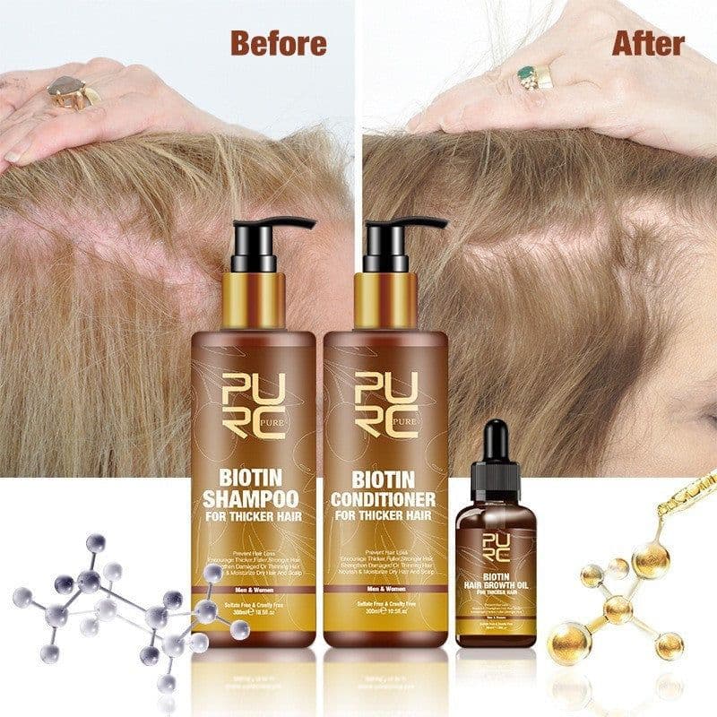 image-PURC Hair Care Ginger Biotin Three-piece Shampoo Conditioner Repair Dry And Frizz Essential Oil