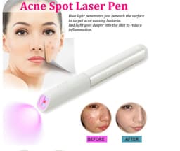 image-Household Safety Red Blue Light Smallpox Diluting Acne Beauty Instrument