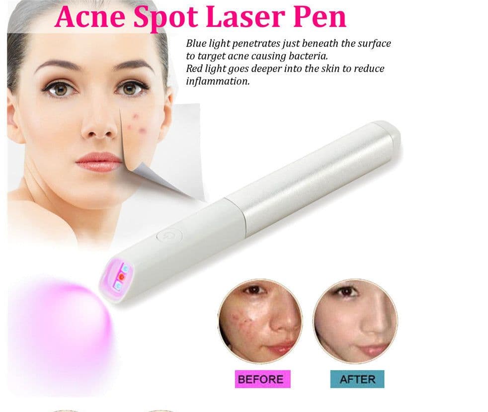 image-Household Safety Red Blue Light Smallpox Diluting Acne Beauty Instrument